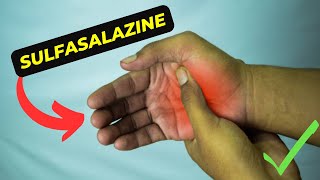 Sulfasalazine The Miracle Drug for Inflammatory Conditions [upl. by Harty]