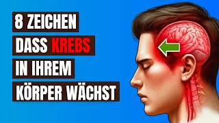 Vernachlässigen Sie Nicht Diese 8 Frühen Anzeichen von Krebs  Sie könnten Ihr Leben retten [upl. by Waldemar]