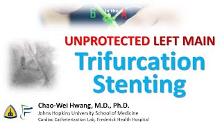 Left Main Trifurcation Stenting [upl. by Beaner]