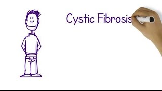 What Is Cystic Fibrosis [upl. by Aicital377]