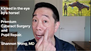 Kicked in the eye by a horse Pupil repair and premium cataract surgery Shannon Wong MD [upl. by Hills]