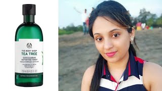 I tried body shop tea tree toner for a month  This is what happened  suitable for blemished skin [upl. by Biondo482]