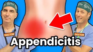 Appendicitis  How Do I Know If I Have Appendicitis [upl. by Kendre]