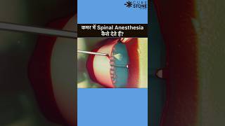 Spinal Anesthesia  How spinal is given  Epidural Anesthesia rirssurgery pregenency [upl. by Malory]