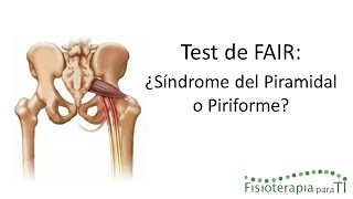 Test de Fair Cómo detectar el síndrome del piramidal o piriforme  Fisioterapia para TI [upl. by Ad]