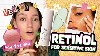 Honest Review Testing versed RETINOL on Sensitive AcneProne Skin [upl. by Ayikaz363]