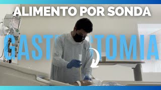 ¿COMO ADMINISTRAR una ALIMENTACION POR SONDA de GASTROSTOMIA  VIDEO PRACTICO [upl. by Ycat]