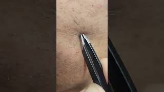 Tweezing Stubborn Facial Hairs Extraction Tweezers [upl. by Tutt799]