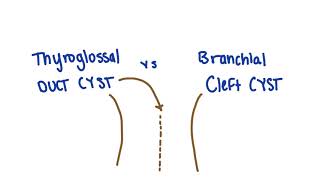 Thyroglossal duct cyst vs branchial cleft cyst remnants mnemonic  USMLE [upl. by Haswell]