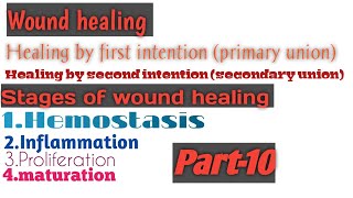 Wound healingstages of wound healinghemostasisinflammationproliferationmaturationPart10 [upl. by Adna326]