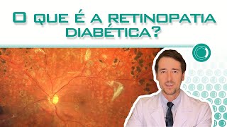 O que é a retinopatia diabética [upl. by Mali]