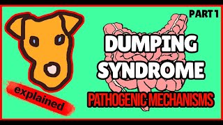 Dumping syndrome Part 1 Definition Physiology General concepts [upl. by Holmann446]