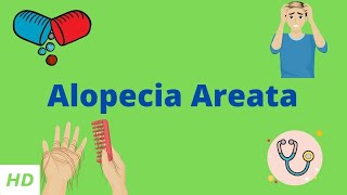 Alopecia Areata Causes SIgns and Symptoms Diagnosis and Treatment [upl. by Ballard]