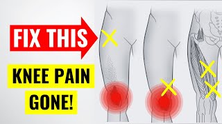 The 1 Hidden Cause of Chronic Knee Pain [upl. by Butler287]