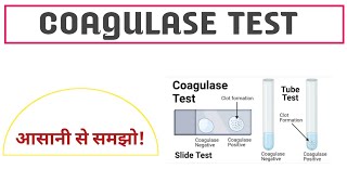 Coagulase Test ll Purpose ll Principle ll Procedure ll result ll in hindi ll [upl. by Carmelita596]