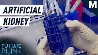 This Artificial Kidney Functions Only On Blood Pressure  Mashable [upl. by Aicina593]