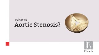 What is Aortic Stenosis [upl. by Alexine411]