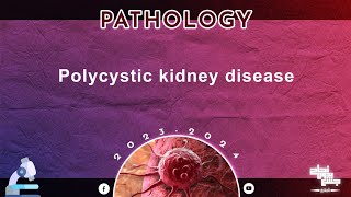 L  Polycystic kidney disease BNU Pathology [upl. by Carlos]