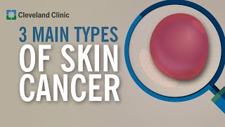 3 Types of Skin Cancer [upl. by Nerred]