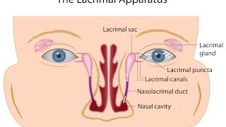 Nasolacrimal Duct Obstruction [upl. by Raji]