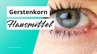 Gerstenkorn 5 Hausmittel und Tipps [upl. by Rutledge]