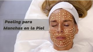 Peeling para Manchas en la Piel [upl. by Annay]