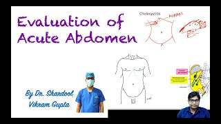 Evaluation of Acute abdomen [upl. by Von]