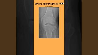 Whats Your Diagnosis 👀radiology radiography doctor nurse medicalstudent medicaltest [upl. by Kiraa]