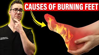 Top 11 Causes of Burning Feet amp Peripheral Neuropathy Instant FIX [upl. by Odnam]