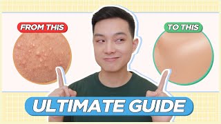 ULTIMATE GUIDE to Treat amp Prevent BLACKHEADS WHITEHEADS TINY BUMPS for FILIPINO SKIN  Jan Angelo [upl. by Nnaaihtnyc]