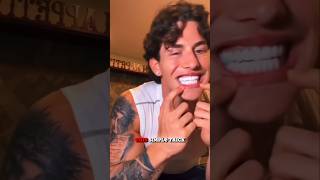 How to white your teeth in just 20 seconds 😱 [upl. by Laehcor137]