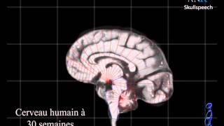 Croissance et formation du cerveau de lembryon et du foetus in utéro [upl. by Lebisor]