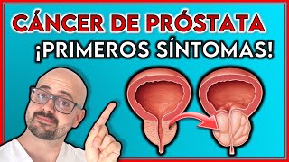 ESTOS son los 7 PRIMEROS SÍNTOMAS del CÁNCER DE PRÓSTATA ¡SEÑALES que NO debes IGNORAR [upl. by Glenda]