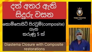 දත් අතර සිදුරු වසන දතේ පාට පිරවුම් l Composite restorations l Diastema closure lGaps between teeth [upl. by Moira]