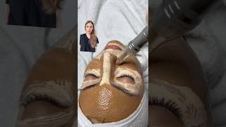 Watch Out BB Glow Facial Could Be Your Beauty Nightmare [upl. by Merton196]