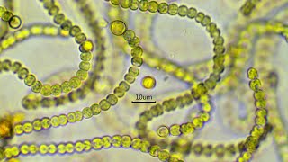 Nostoc commune  the nitrogen fixing cyanobacterium [upl. by Nanreh858]