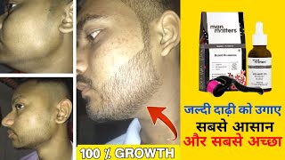 grow beard faster  how to grow beard in 1 month  man matters beard growth kit review [upl. by Lahpos]