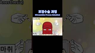 포경수술 과정The Circumcision Process Animation animation 병맛애니 [upl. by Lledra]