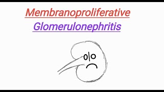 Membranoproliferative glomerulonephritis MPGN  Nephrotic Syndrome  USMLE Step1 [upl. by Brien]