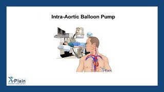 IntraAortic Balloon Pump [upl. by Tacklind755]