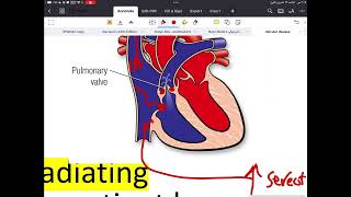 valvular heart disease p6 TR PS [upl. by Karoline]