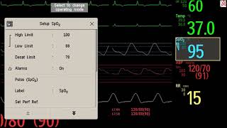 Philips IntelliVue Patient Monitoring Basic Operation [upl. by Panthea695]