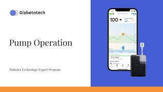 Pump Operation  Tandem Mobi Insulin Pump  Diabetotech [upl. by Kavanagh267]