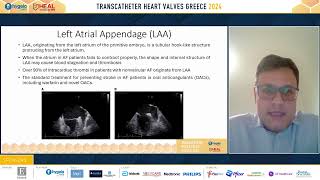 74 Devices for transcatheter closure of ASDPFO and LAA Similarities and differences [upl. by Layol]