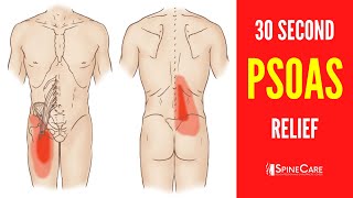 How to Fix a Tight Psoas Muscle in 30 SECONDS [upl. by Fayola]