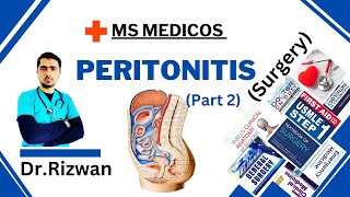 Peritonitis Part 2SurgeryMS MedicosDr RizwanUrdu Hindi Easy Explanations [upl. by Nacim]