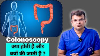 Colonoscopy क्या होती है और क्यों की जाती है   कोलोनोस्कोपी बड़ी आंत की जांच कैसे की जाती है [upl. by Ohploda520]