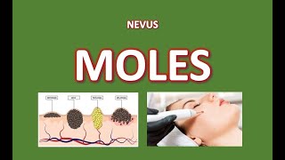 Learning The Different Types of Moles Examination And Removal [upl. by Hester]