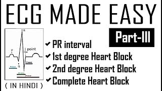 ECG MADE EASY  Part 3  PR Interval  1st 2nd amp 3rd degree Complete Heart Blocks  DrEDUCATION [upl. by Ennazus464]