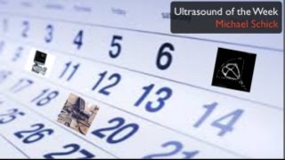 Ultrasound of the Week  Necrotizing pneumonia and tamponade [upl. by Phylis501]